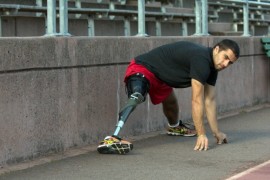 使用3D打印技术开发可调式假腿（图文教程）